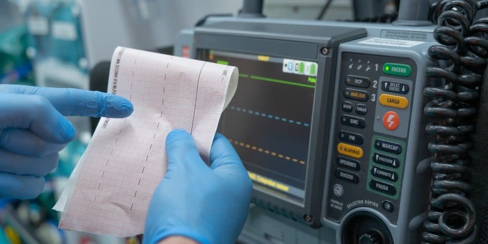 AI Offers Benefits for Initial Echocardiographic Assessment