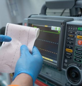 AI Offers Benefits for Initial Echocardiographic Assessment