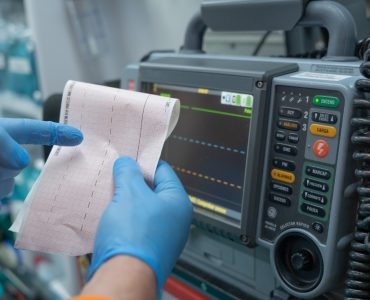 AI Offers Benefits for Initial Echocardiographic Assessment