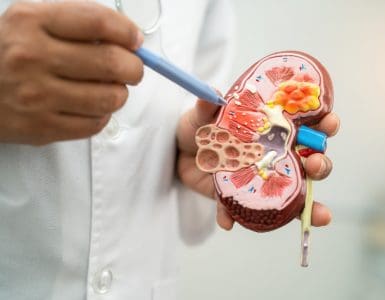 First-line treatment for patients with advanced RCC