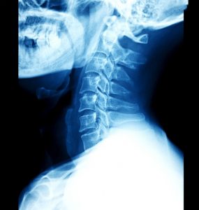 Locate Bio's LDGraft receives US FDA breakthrough device designation