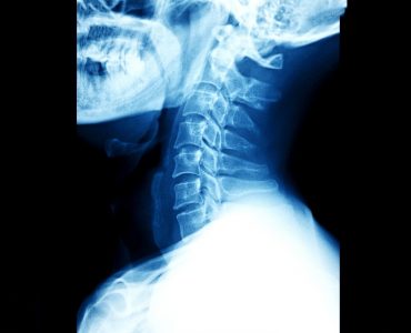 Locate Bio's LDGraft receives US FDA breakthrough device designation
