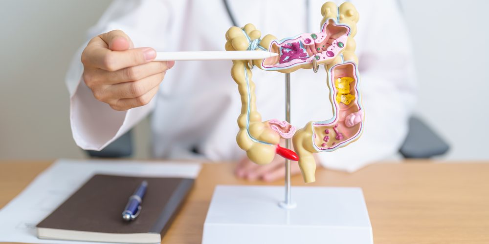 New Drug Awaiting FDA Approval: Omvoh Could Boost Outcomes for People With Ulcerative Colitis