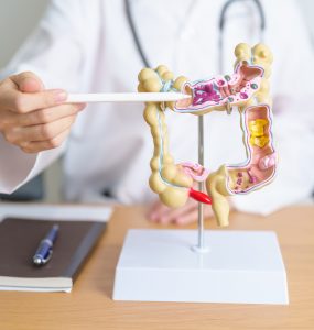 New Drug Awaiting FDA Approval: Omvoh Could Boost Outcomes for People With Ulcerative Colitis