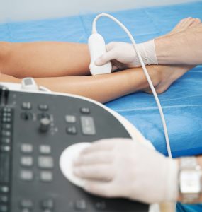 FDA approves LimFlow system for patients with CLTI