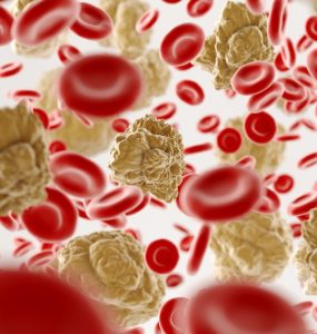 Nieuwe behandeling voor sikkelcelziekte en thalassemie goedgekeurd in VK